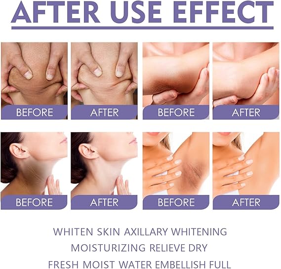 Underarm Dark Spot Corrector Cream – Whitening & Brightening Treatment for Sensitive Skin
